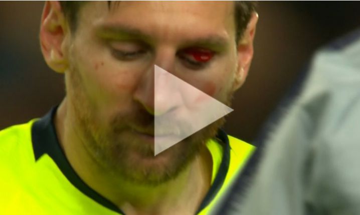 Messi UCIERPIAŁ w starciu ze Smallingiem! [VIDEO]